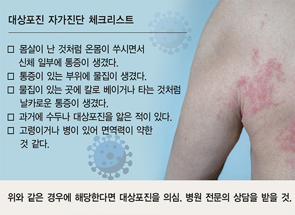 대상포진 예방접종 안내