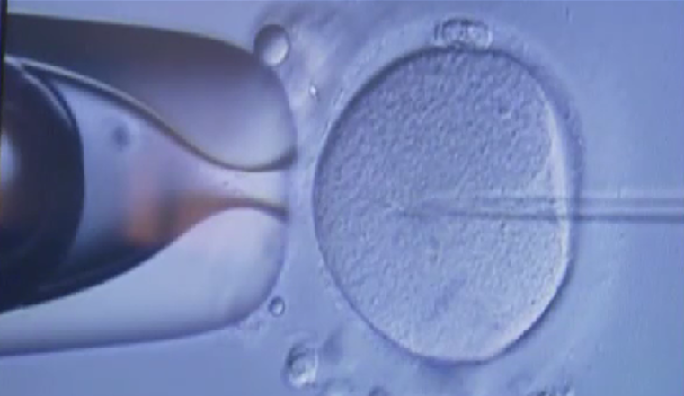 서울시 경기도 난자 냉동 시술비 지원 안내 이미지