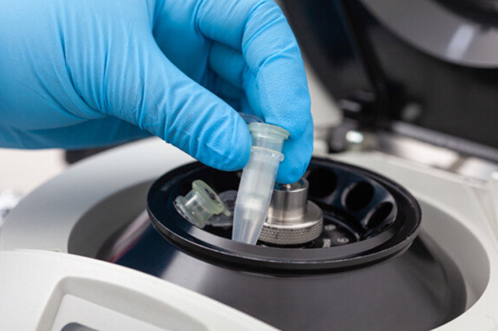 난자 냉동 시술 과정과 주의사항 안내 이미지