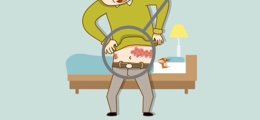 대상포진 예방접종 접종 후 관리