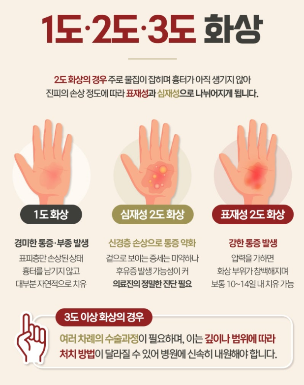 2도화상 물집과 피부 손상 깊이 설명