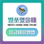 벌 쏘였을때 응급처치 순서부터 병원 무슨과까지 한 번에 정리 벌 쏘였을때 응급처치 순서부터 병원 무슨과까지 한 번에 정리